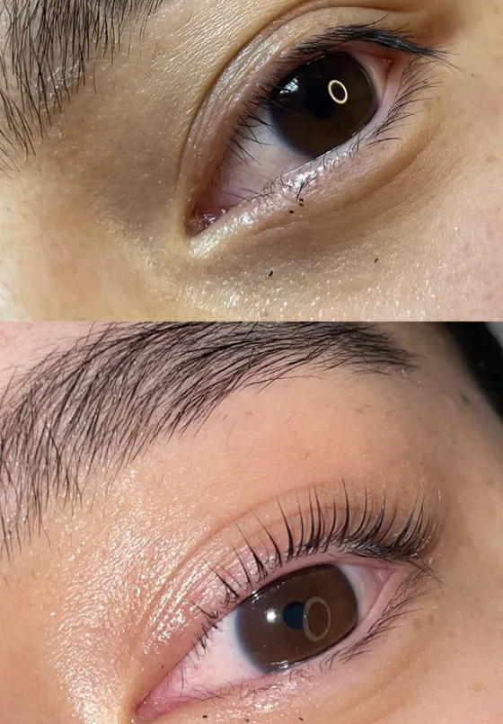 Wimpernlifting vorher und nachher