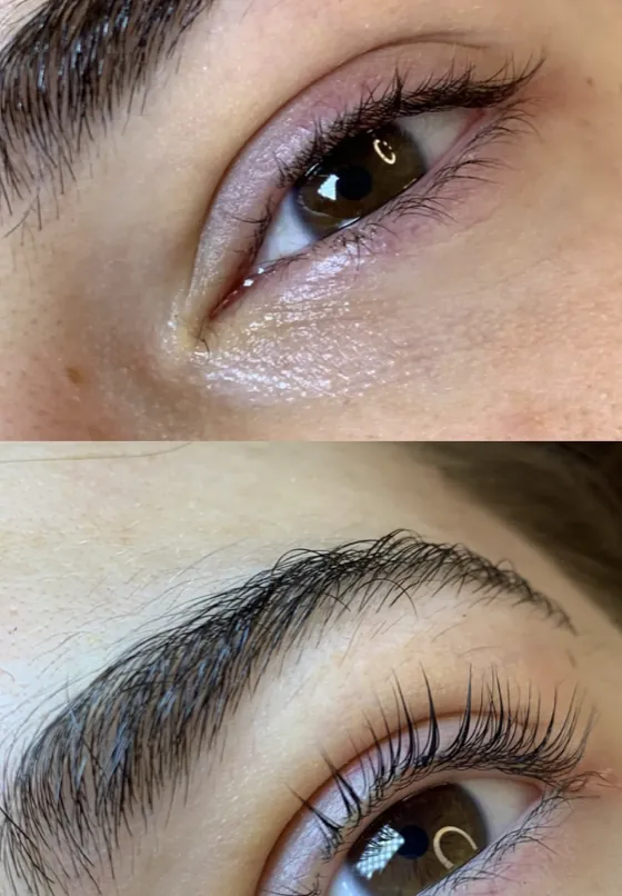 Wimpernlifting vorher und nachher
